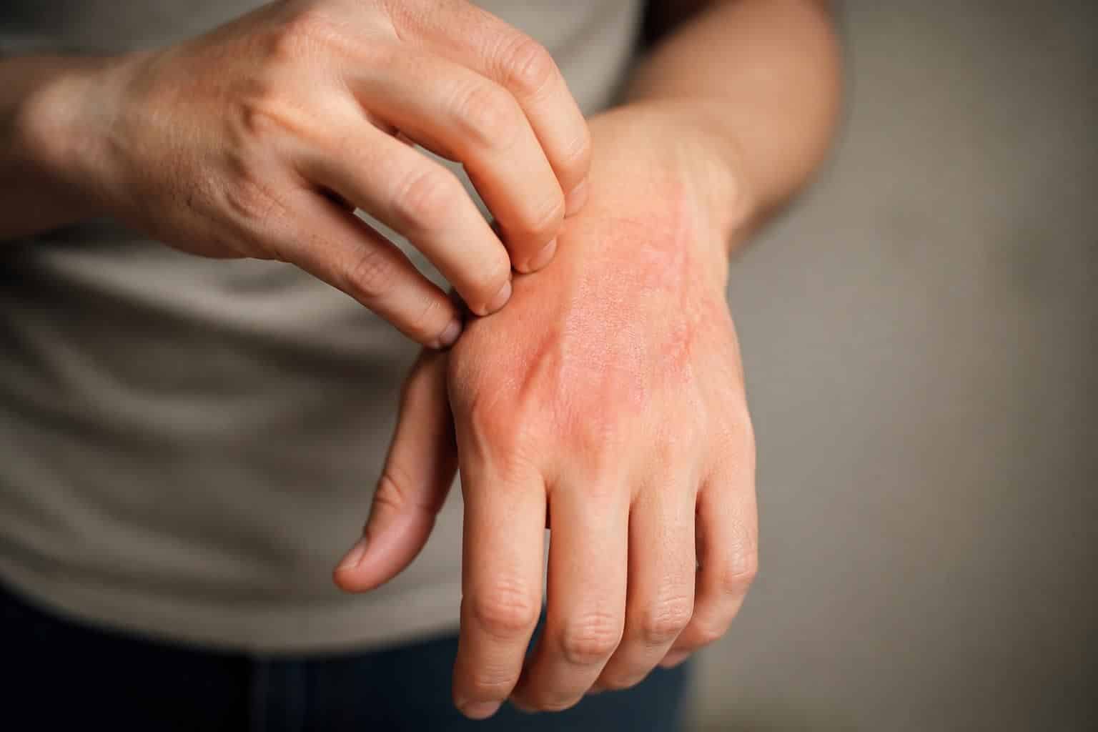 découvrez les causes courantes et la signification de la sensation de démangeaison à la main droite, pour mieux comprendre ce phénomène fréquent.